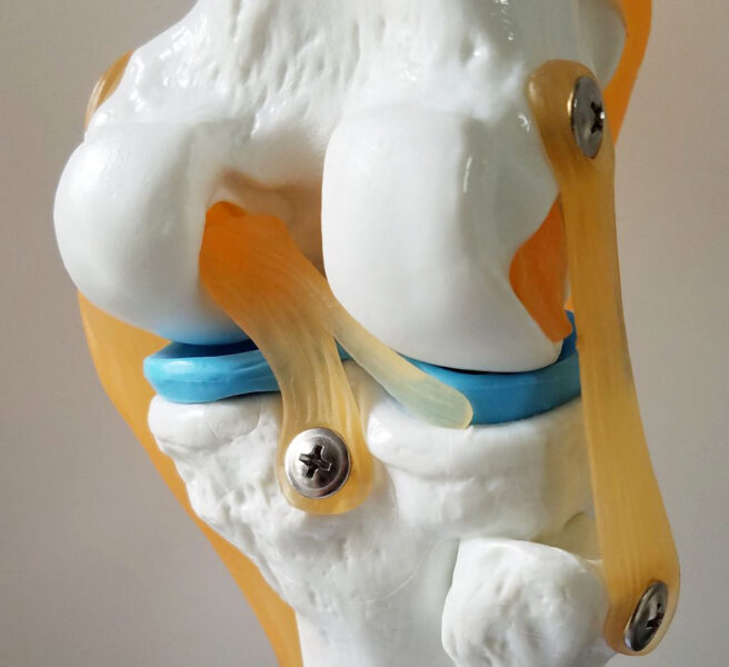 膝の人体模型
